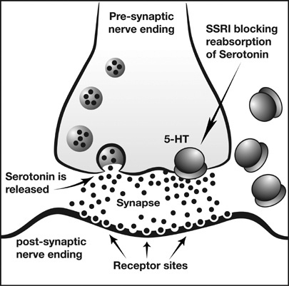 serotonin-blocker